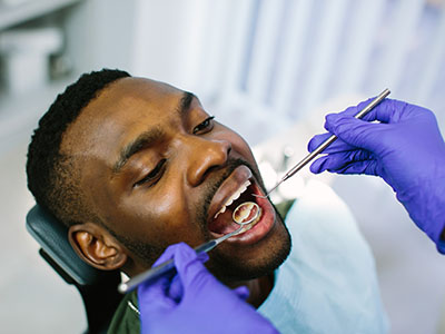 Ukiah Oral Surgery   Dental Implants | Apicoectomy, Oral   Facial Trauma and Frenectomy